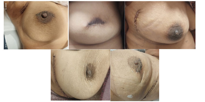 Final Result after RAFBPS 